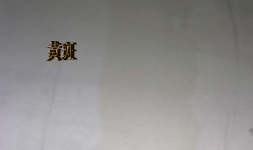 黄斑